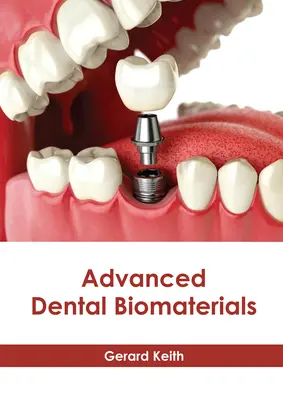 Fejlett fogászati bioanyagok - Advanced Dental Biomaterials