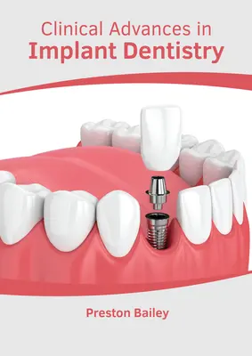 Klinikai előrelépések az implantológiai fogászatban - Clinical Advances in Implant Dentistry