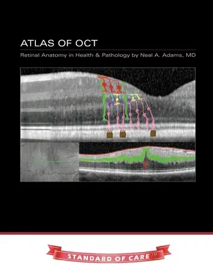 OCT-atlasz: Retina anatómia az egészségügyben és a patológiában - Atlas of OCT: Retinal Anatomy in Health & Pathology