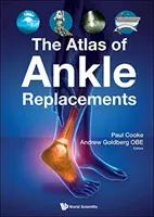 A bokapótlások atlasza - The Atlas of Ankle Replacements