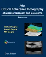 A makulabetegségek és a glaukóma optikai koherencia-tomográfiája atlaszban - Atlas Optical Coherence Tomography of Macular Diseases and Glaucoma