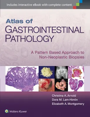 Atlas of Gastrointestinal Pathology: A nem neoplasztikus biopsziák mintaalapú megközelítése - Atlas of Gastrointestinal Pathology: A Pattern Based Approach to Non-Neoplastic Biopsies