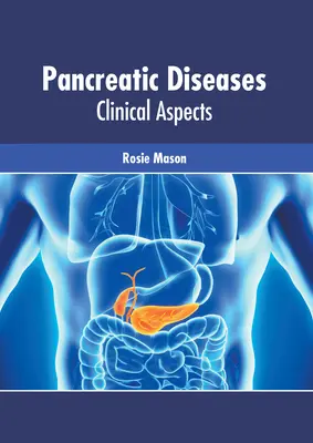 Hasnyálmirigy-betegségek: Panaszkuláris betegségek: Klinikai szempontok - Pancreatic Diseases: Clinical Aspects