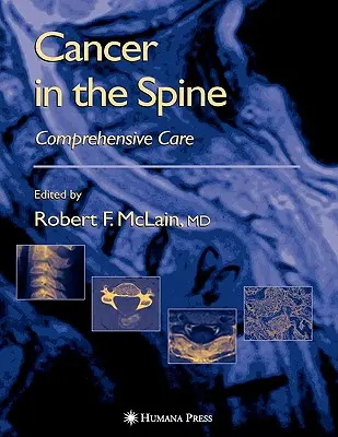 Rák a gerincben: Átfogó gondozás - Cancer in the Spine: Comprehensive Care