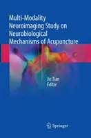 Az akupunktúra neurobiológiai mechanizmusainak multimodális neuroképalkotó vizsgálata - Multi-Modality Neuroimaging Study on Neurobiological Mechanisms of Acupuncture