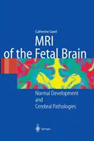 A magzati agy MRI-je: Normális fejlődés és agyi kórképek - MRI of the Fetal Brain: Normal Development and Cerebral Pathologies