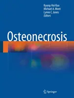 Csontritkulás - Osteonecrosis