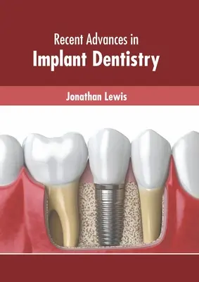 Az implantológiai fogászat legújabb eredményei - Recent Advances in Implant Dentistry