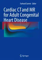 Szív CT és MR a felnőttkori veleszületett szívbetegségeknél - Cardiac CT and MR for Adult Congenital Heart Disease