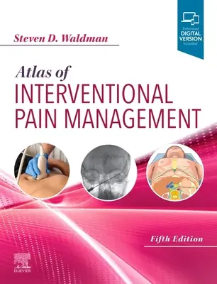 Az intervenciós fájdalomcsillapítás atlasza - Atlas of Interventional Pain Management