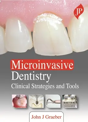 Mikroinvazív fogászat - Klinikai stratégiák és eszközök - Microinvasive Dentistry - Clinical Strategies and Tools