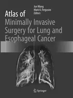 A tüdő- és nyelőcsőrák minimálisan invazív sebészetének atlasza - Atlas of Minimally Invasive Surgery for Lung and Esophageal Cancer