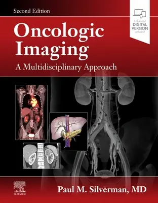 Onkológiai képalkotás: Multidiszciplináris megközelítés - Oncologic Imaging: A Multidisciplinary Approach