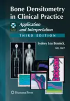 Csontdenzitometria a klinikai gyakorlatban: Alkalmazás és értelmezés - Bone Densitometry in Clinical Practice: Application and Interpretation