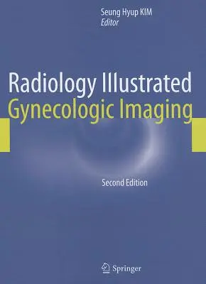 Radiológia illusztrálva: Nőgyógyászati képalkotás - Radiology Illustrated: Gynecologic Imaging