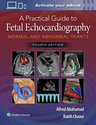 Gyakorlati útmutató a magzati echokardiográfiához: Normális és rendellenes szívek - A Practical Guide to Fetal Echocardiography: Normal and Abnormal Hearts