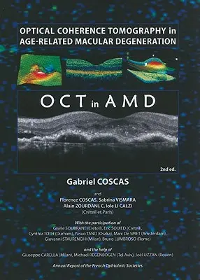 Optikai koherencia tomográfia az időskori makuladegenerációban - Optical Coherence Tomography in Age-Related Macular Degeneration