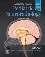 Diagnosztikai képalkotás: Gyermekneuroradiológia - Diagnostic Imaging: Pediatric Neuroradiology