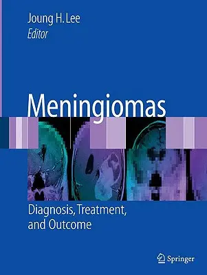 Meningiómák: Diagnózis, kezelés és kimenetel - Meningiomas: Diagnosis, Treatment, and Outcome