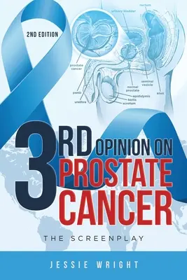 Harmadik vélemény a prosztatarákról: A forgatókönyv - 3rd Opinion on Prostate Cancer: The Screenplay
