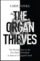 Szervtolvajok - Az első szívátültetés megdöbbentő története az amerikai szegregált délen - Organ Thieves - The Shocking Story of the First Heart Transplant in America's Segregated South