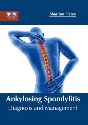 Bechterew-kór: Szindróma: Diagnózis és kezelés - Ankylosing Spondylitis: Diagnosis and Management