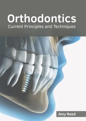 Fogszabályozás: Fogszabályozás: Jelenlegi elvek és technikák - Orthodontics: Current Principles and Techniques