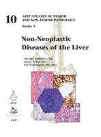 A máj nem neoplasztikus betegségei - Non-Neoplastic Diseases of the Liver