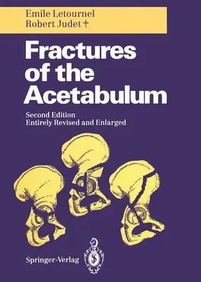 A méhszájpad törései - Fractures of the Acetabulum