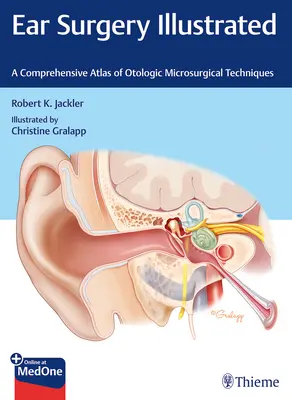 Fülműtét illusztrálva: A fülészeti mikrosebészeti technikák átfogó atlasza - Ear Surgery Illustrated: A Comprehensive Atlas of Otologic Microsurgical Techniques