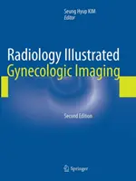 Radiology Illustrated: Nőgyógyászati képalkotás - Radiology Illustrated: Gynecologic Imaging