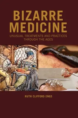 Bizarr orvostudomány: Szokatlan kezelések és gyakorlatok az idők során - Bizarre Medicine: Unusual Treatments and Practices through the Ages