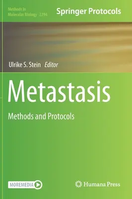 Metasztázis: Metastasis: Módszerek és protokollok - Metastasis: Methods and Protocols