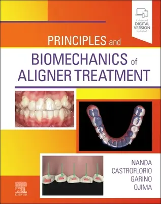 Az Aligner-kezelés alapelvei és biomechanikája - Principles and Biomechanics of Aligner Treatment