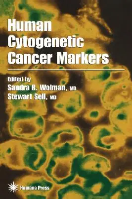 Humán citogenetikai rákmarkerek - Human Cytogenetic Cancer Markers