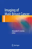 A férfi emlőrák képalkotása - Imaging of Male Breast Cancer