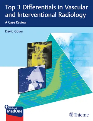 Top 3 differenciáldiagnózis az érrendszeri és intervenciós radiológiában: A Case Review - Top 3 Differentials in Vascular and Interventional Radiology: A Case Review