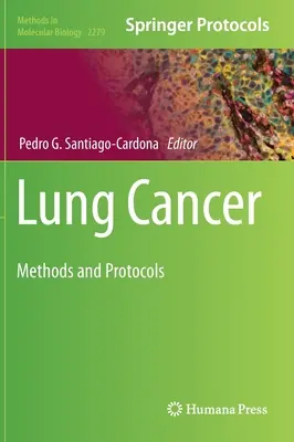 Tüdőrák: Módszerek és protokollok - Lung Cancer: Methods and Protocols