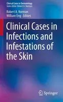 Klinikai esetek a bőrfertőzések és -fertőzések témakörében - Clinical Cases in Infections and Infestations of the Skin