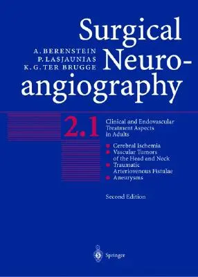 Sebészeti neuroangiográfia: Vol.2: Klinikai és endovaszkuláris kezelési szempontok felnőtteknél - Surgical Neuroangiography: Vol.2: Clinical and Endovascular Treatment Aspects in Adults