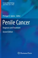 Penisrák: Diagnózis és kezelés - Penile Cancer: Diagnosis and Treatment