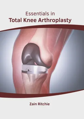 Alapvető tudnivalók a teljes térdprotézisben - Essentials in Total Knee Arthroplasty