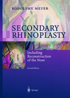 Másodlagos orrplasztika: Beleértve az orr rekonstrukcióját - Secondary Rhinoplasty: Including Reconstruction of the Nose