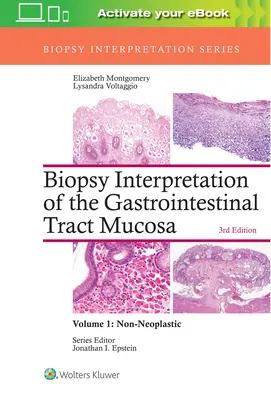 A gasztrointesztinális traktus nyálkahártyájának biopsziaértelmezése: 1. kötet: Nem neoplasztikus kórképek - Biopsy Interpretation of the Gastrointestinal Tract Mucosa: Volume 1: Non-Neoplastic