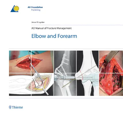 Ao Manual of Fracture Management - Elbow & Forearm (A törések kezelésének kézikönyve - könyök és alkar) - Ao Manual of Fracture Management - Elbow & Forearm