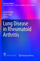 Tüdőbetegség a reumatoid artritiszben - Lung Disease in Rheumatoid Arthritis