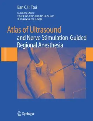 Az ultrahang és az idegstimuláció által vezérelt regionális érzéstelenítés atlasza - Atlas of Ultrasound and Nerve Stimulation-Guided Regional Anesthesia