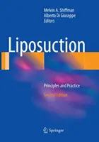 Zsírleszívás: Alapelvek és gyakorlat - Liposuction: Principles and Practice