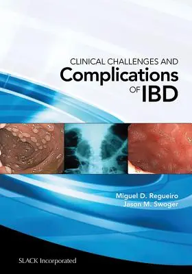 Az Ibd klinikai kihívásai és szövődményei - Clinical Challenges and Complications of Ibd