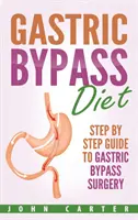 Gastric Bypass Diet: Lépésről lépésre útmutató a gyomor-bypass műtéthez - Gastric Bypass Diet: Step By Step Guide to Gastric Bypass Surgery